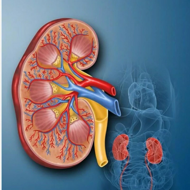 تصویر پکیج رفع سنگ کلیه گیاهی